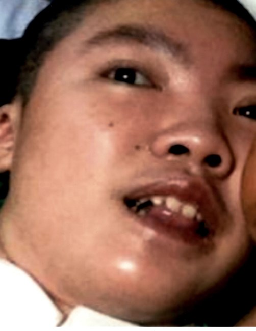 Obituary of Patrick Tuon