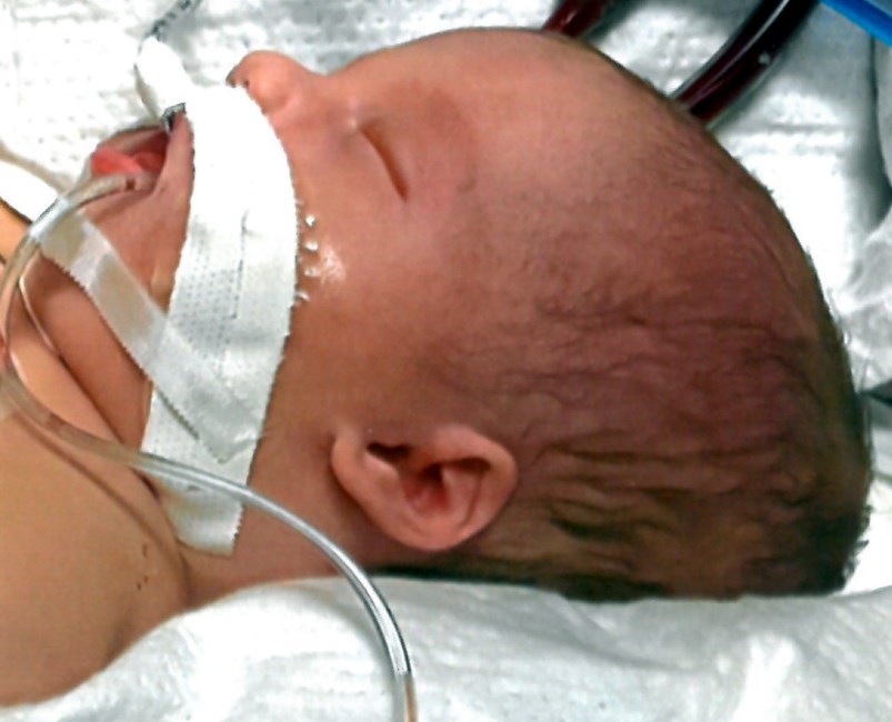 Obituary of Reese Thomas Lauer