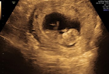 Obituary of Jose Guadalupe Reyes