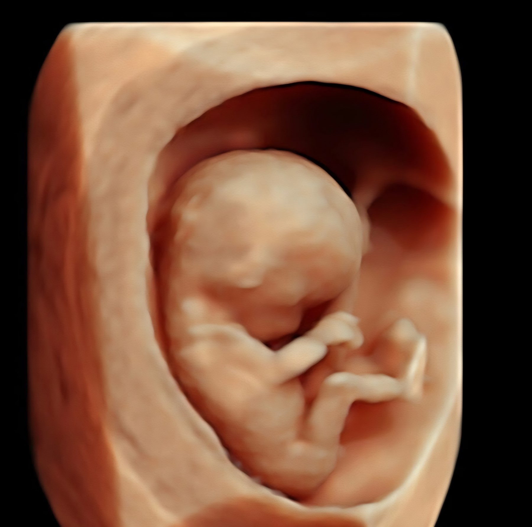 Obituary of Evyana Dream Rowan