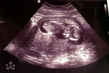 Obituary of Edgar Trinidad Trujillo