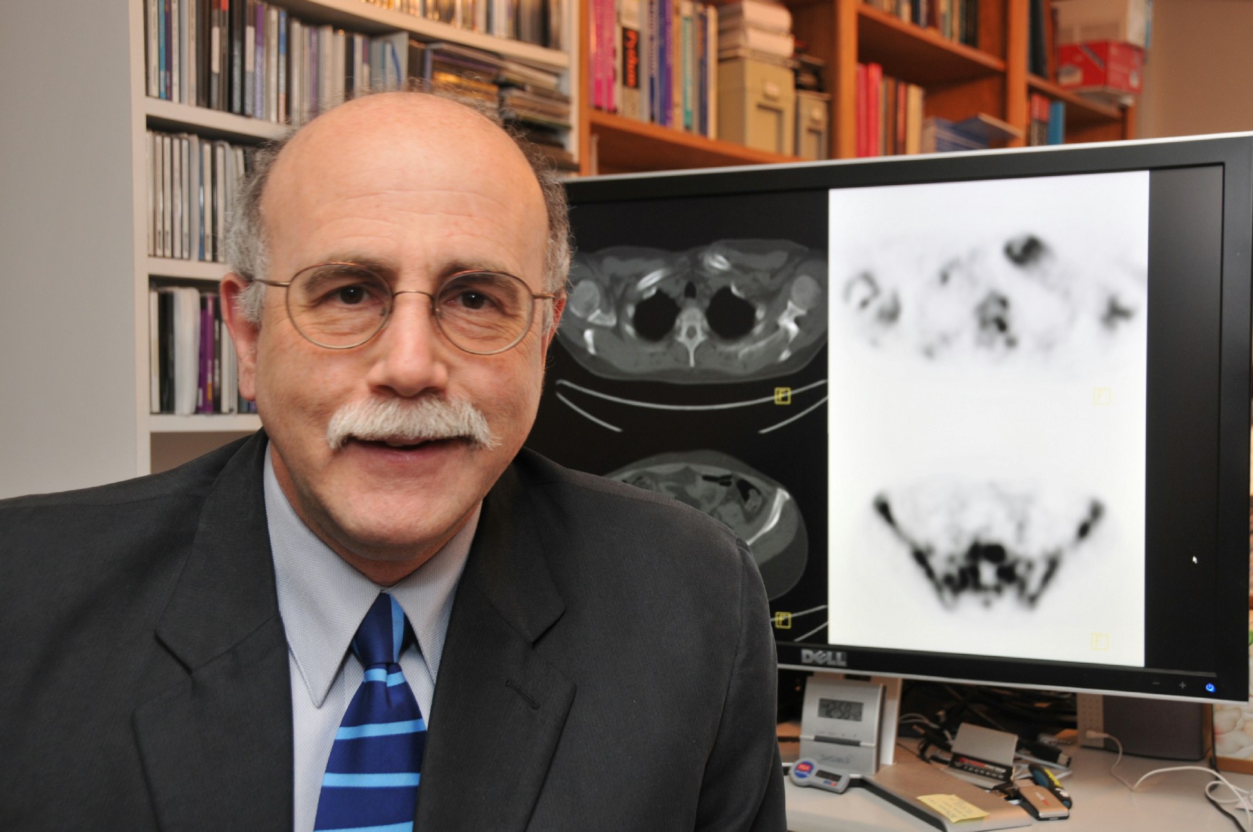 Obituary of David A. Israel MD., Ph.D.