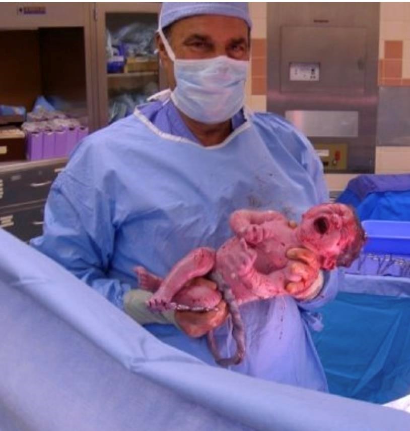 Obituary of Michael J. Benjamin MD