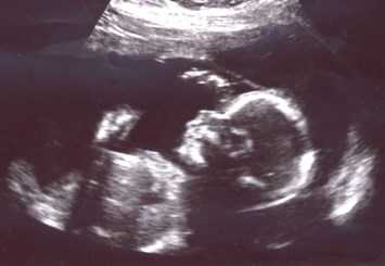 Obituary of Bella Esperanza Hernandez