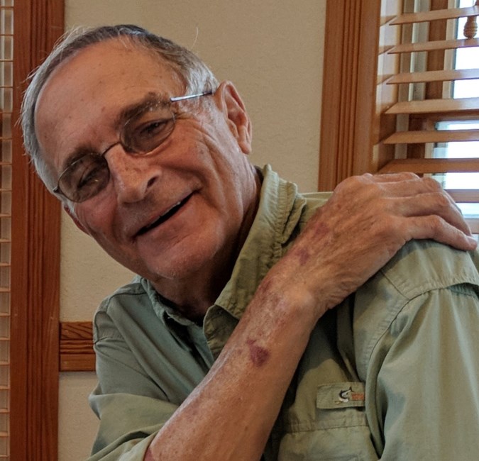 Obituary of Calvin Charles Hunkele