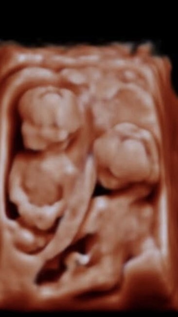 Avis de décès de Remi Raine Faith Kates