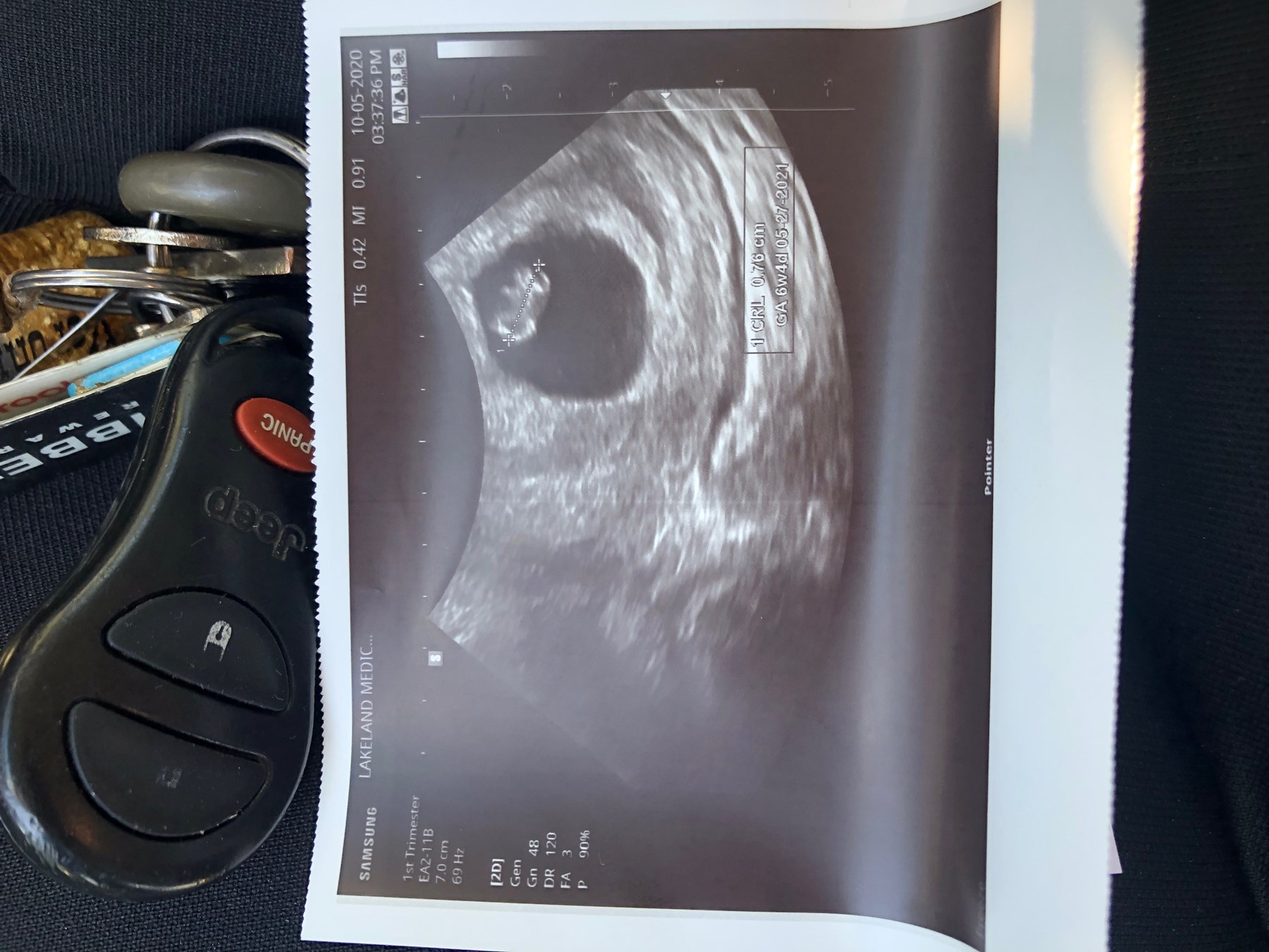 Obituary of Lucas Hernandez-Acosta