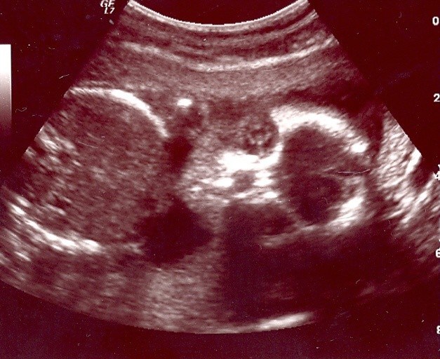 Obituario de Brianna Jaylend Cabrera